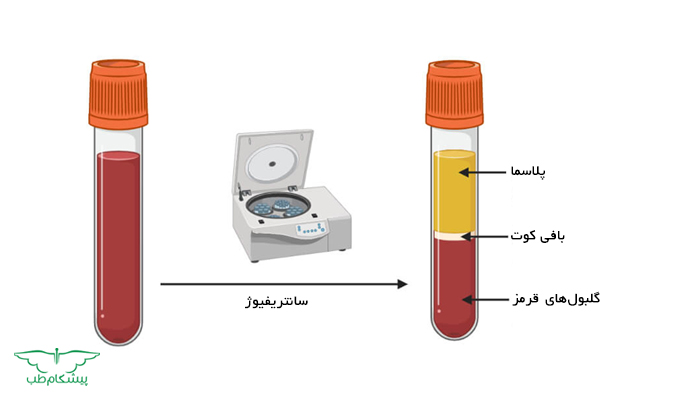 پی ار پی