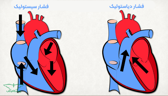 فشار سیستولیک و دیاستولیک